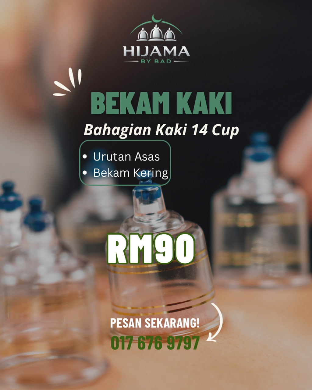 Bekam Kaki